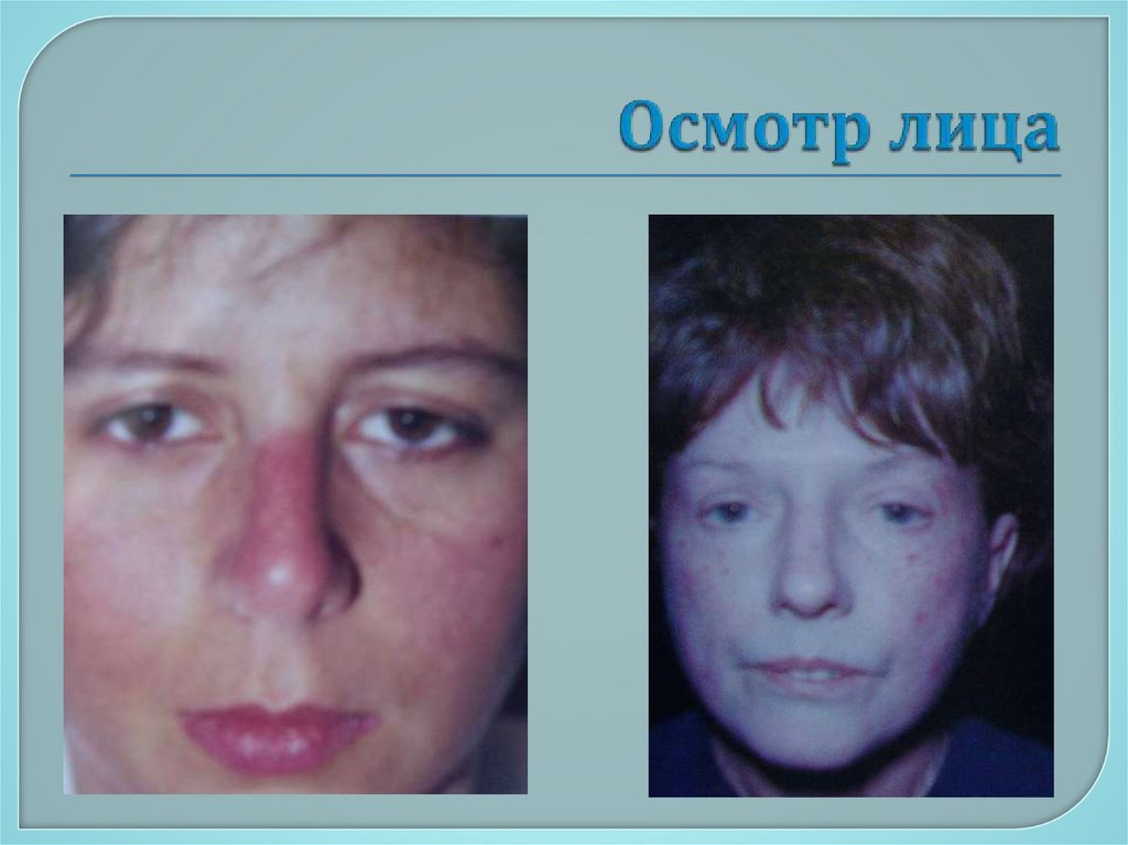 Осмотр лица