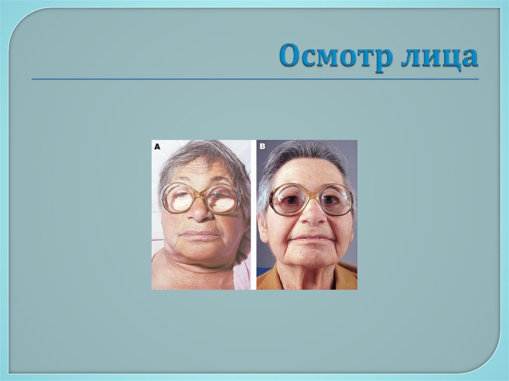 Осмотр лица