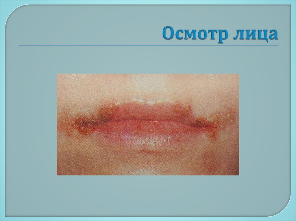 Осмотр лица