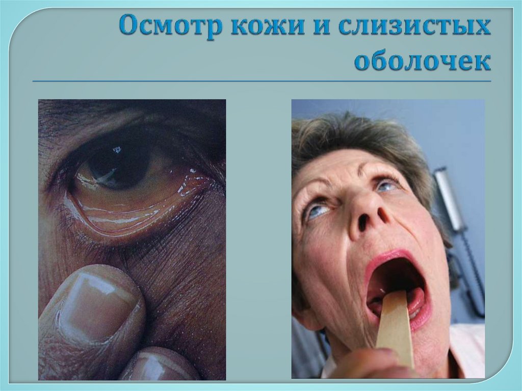 Осмотр кожи и слизистых оболочек