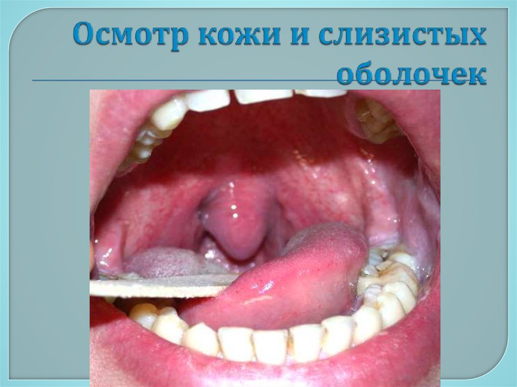 Осмотр кожи и слизистых оболочек