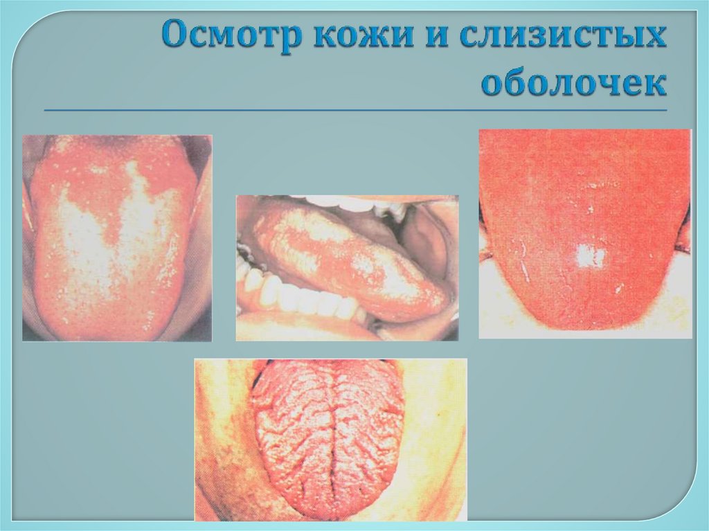 Осмотр кожи и слизистых оболочек
