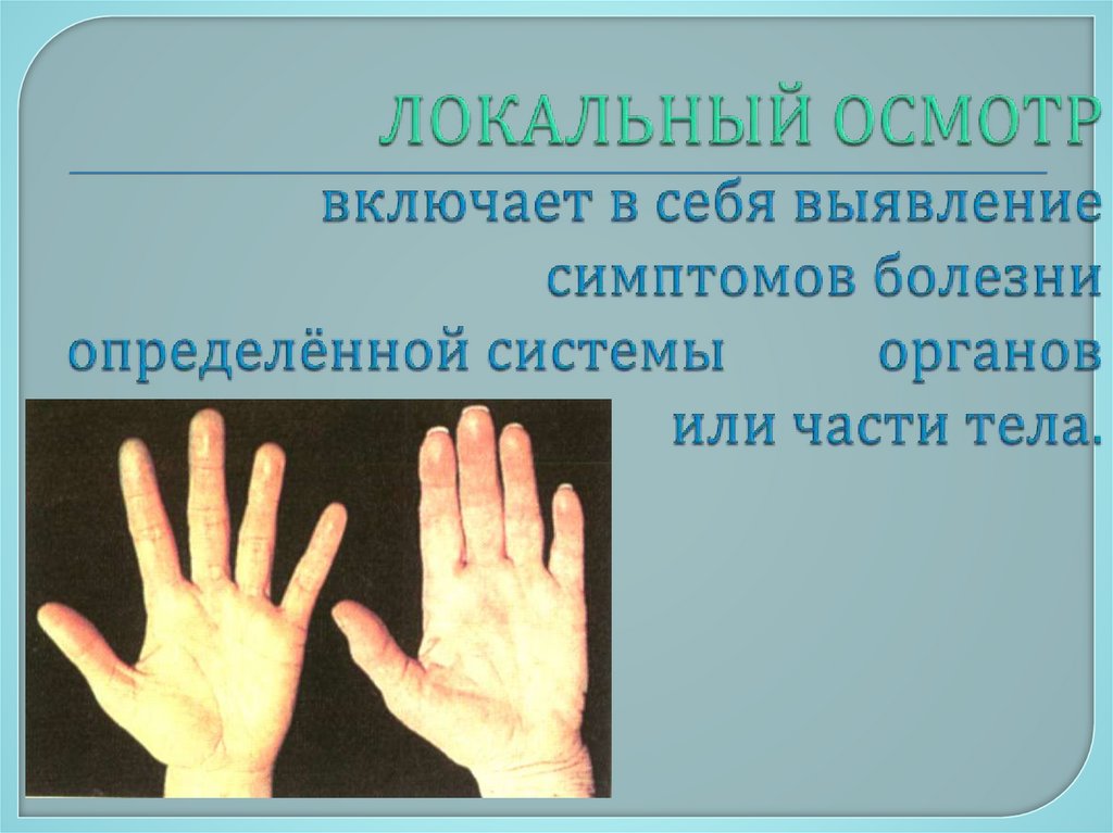 ЛОКАЛЬНЫЙ ОСМОТР включает в себя выявление симптомов болезни определённой системы органов или части тела.