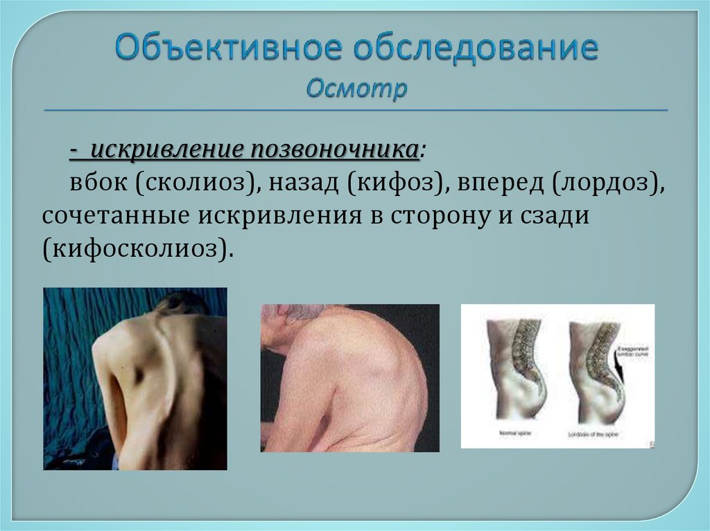 Объективное обследование Осмотр