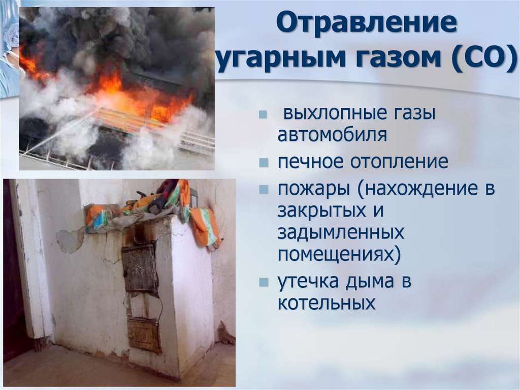 Отравление угарным газом (СО)