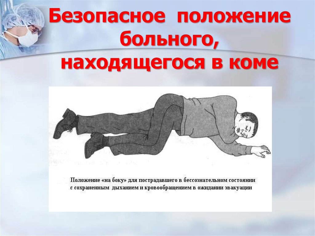 Безопасное положение больного, находящегося в коме