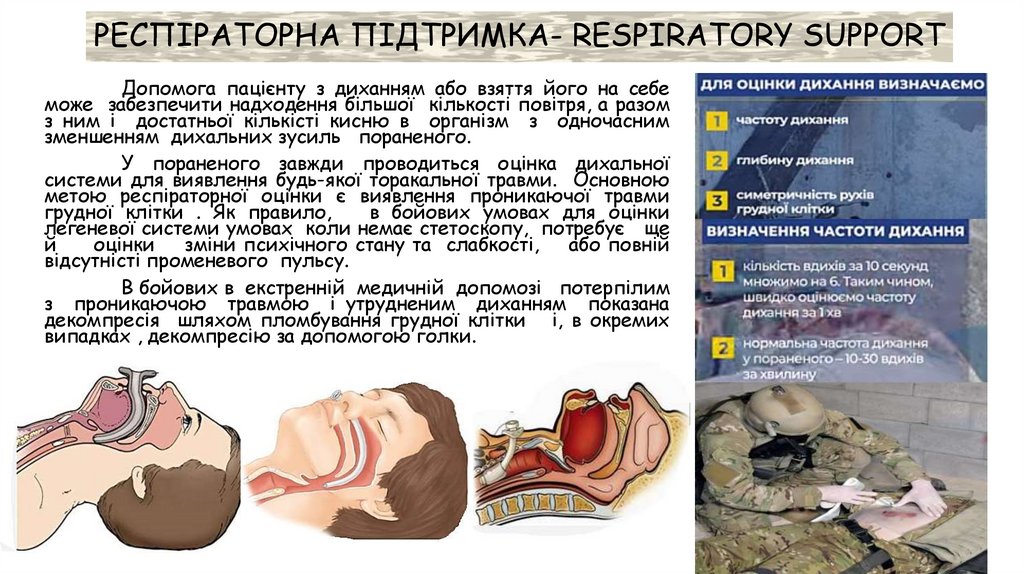 РЕСПІРАТОРНА ПІДТРИМКА- RESPIRATORY SUPPORT