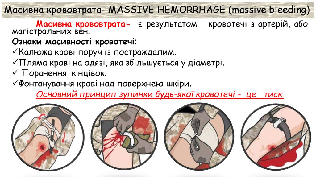 Масивна крововтрата- MASSIVE HEMORRHAGE (massive bleeding)
