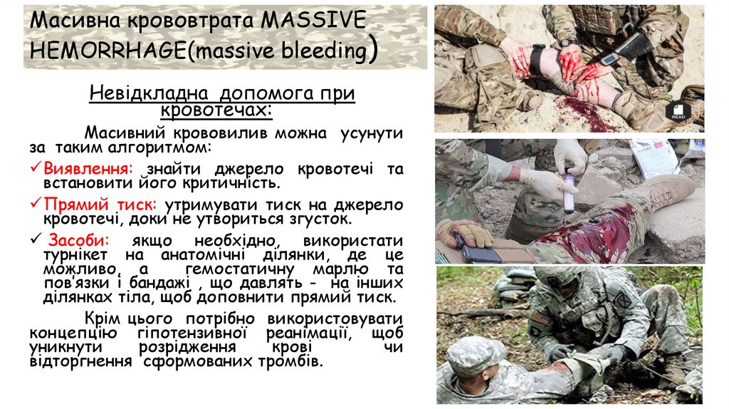 Масивна крововтрата MASSIVE HEMORRHAGE(massive bleeding)