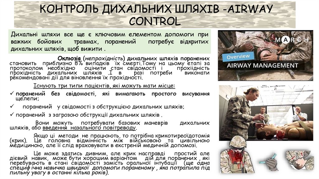 КОНТРОЛЬ ДИХАЛЬНИХ ШЛЯХІВ -AIRWAY CONTROL