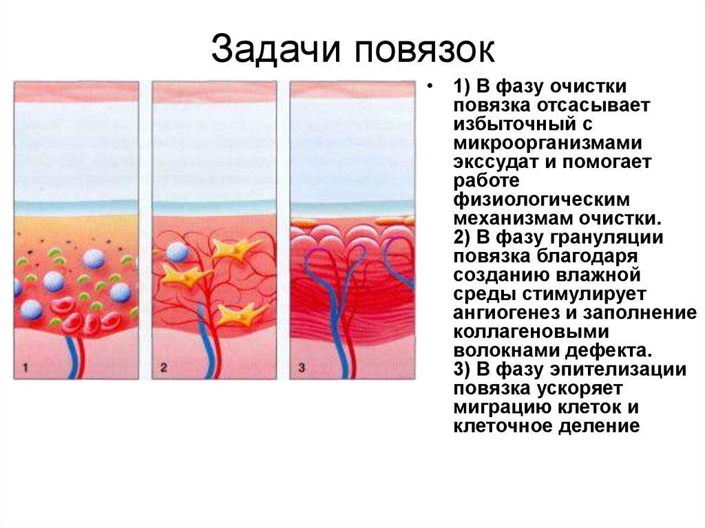 Задачи повязок