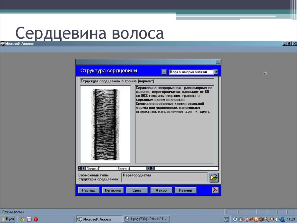 Сердцевина волоса