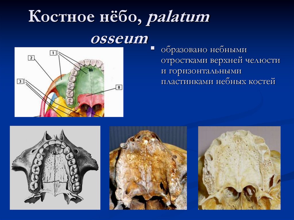 Костное нёбо, palatum osseum