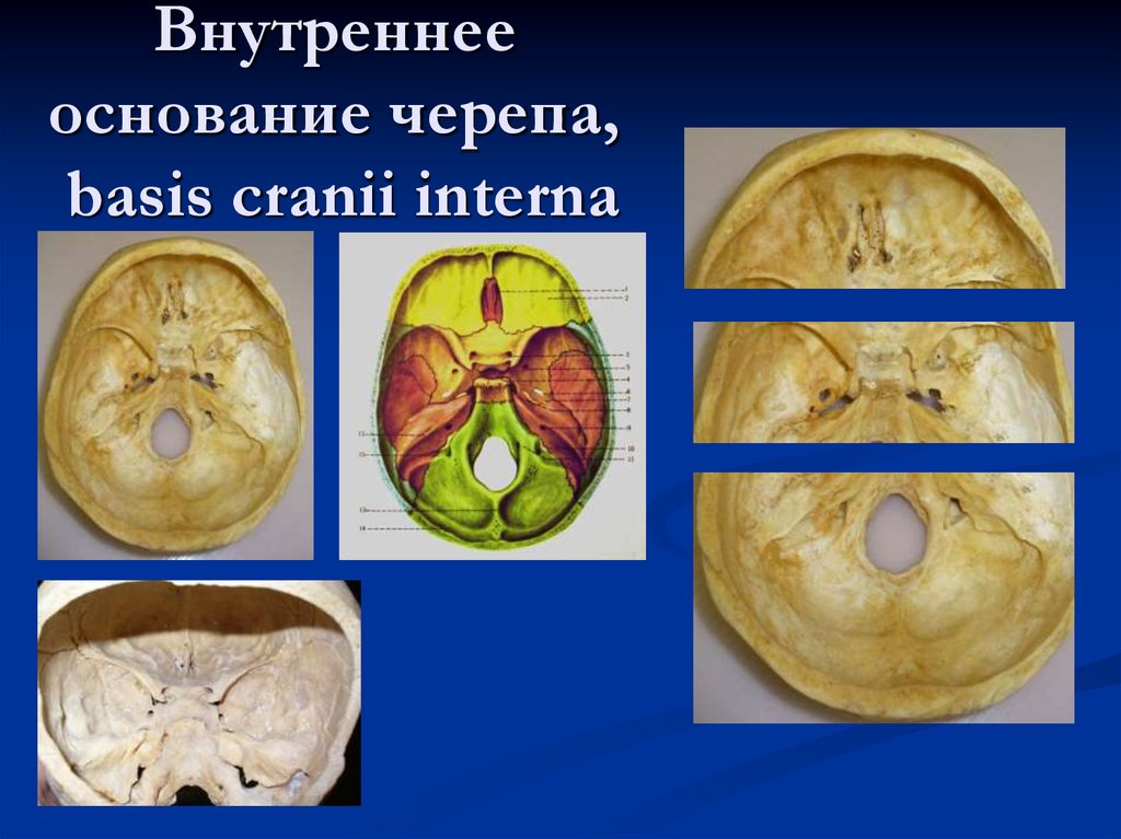 Внутреннее основание черепа, basis cranii interna