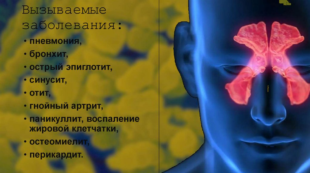 Вызываемые заболевания: