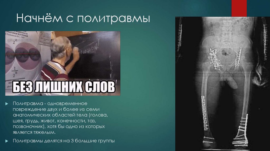 Начнём с политравмы