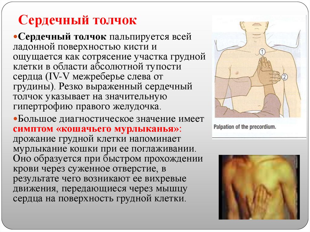 Сердечный толчок