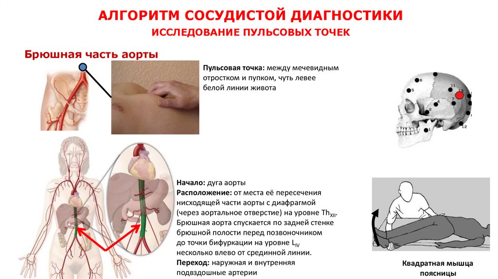 АЛГОРИТМ СОСУДИСТОЙ ДИАГНОСТИКИ ИССЛЕДОВАНИЕ ПУЛЬСОВЫХ ТОЧЕК