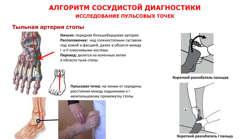 АЛГОРИТМ СОСУДИСТОЙ ДИАГНОСТИКИ ИССЛЕДОВАНИЕ ПУЛЬСОВЫХ ТОЧЕК