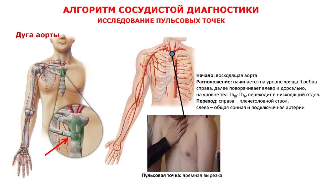 АЛГОРИТМ СОСУДИСТОЙ ДИАГНОСТИКИ ИССЛЕДОВАНИЕ ПУЛЬСОВЫХ ТОЧЕК