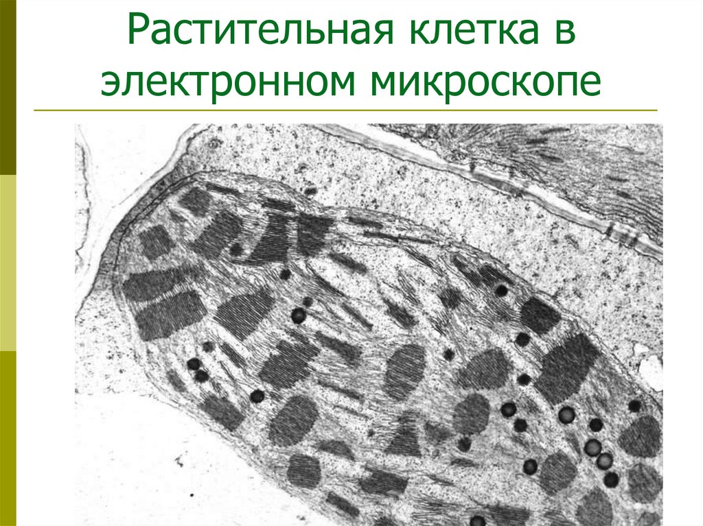 Растительная клетка в электронном микроскопе