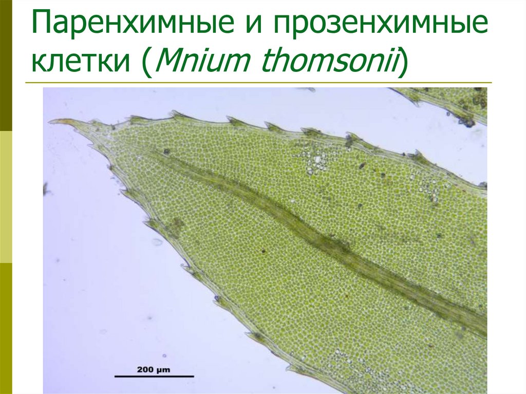 Паренхимные и прозенхимные клетки (Mnium thomsonii)