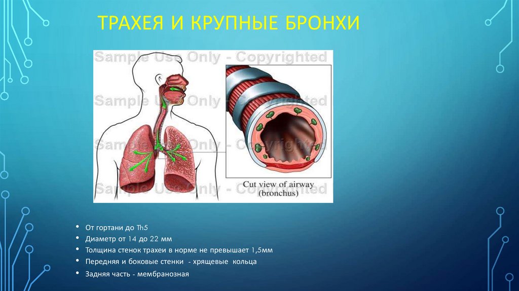 Трахея и крупные бронхи
