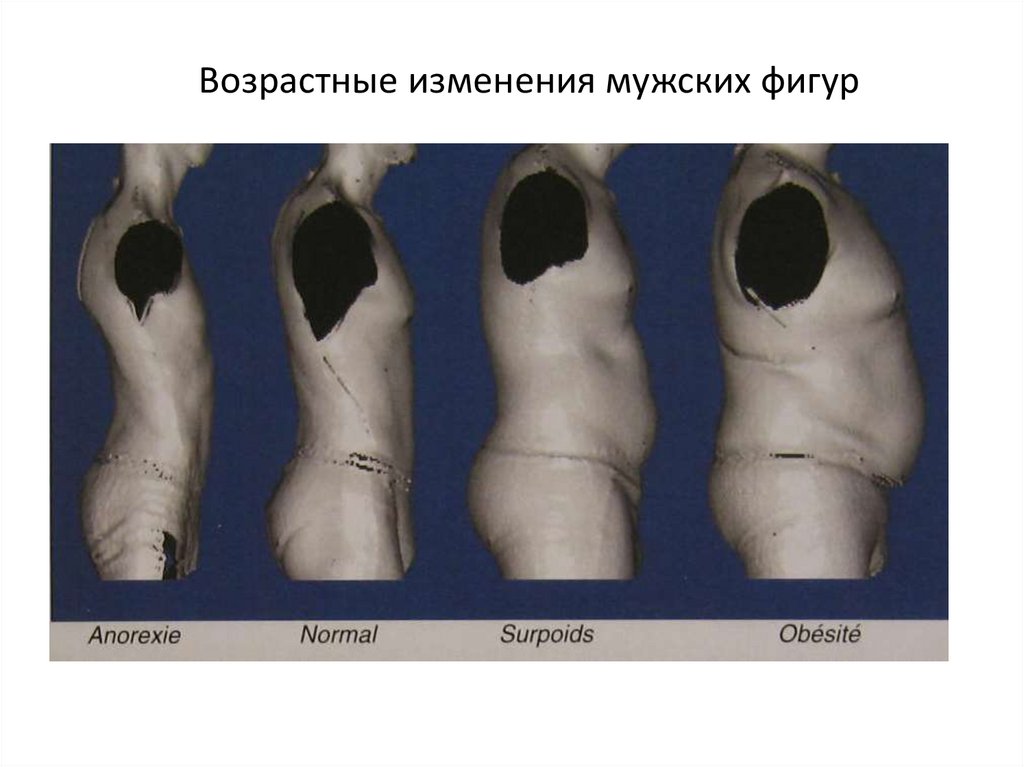 Возрастные изменения мужских фигур