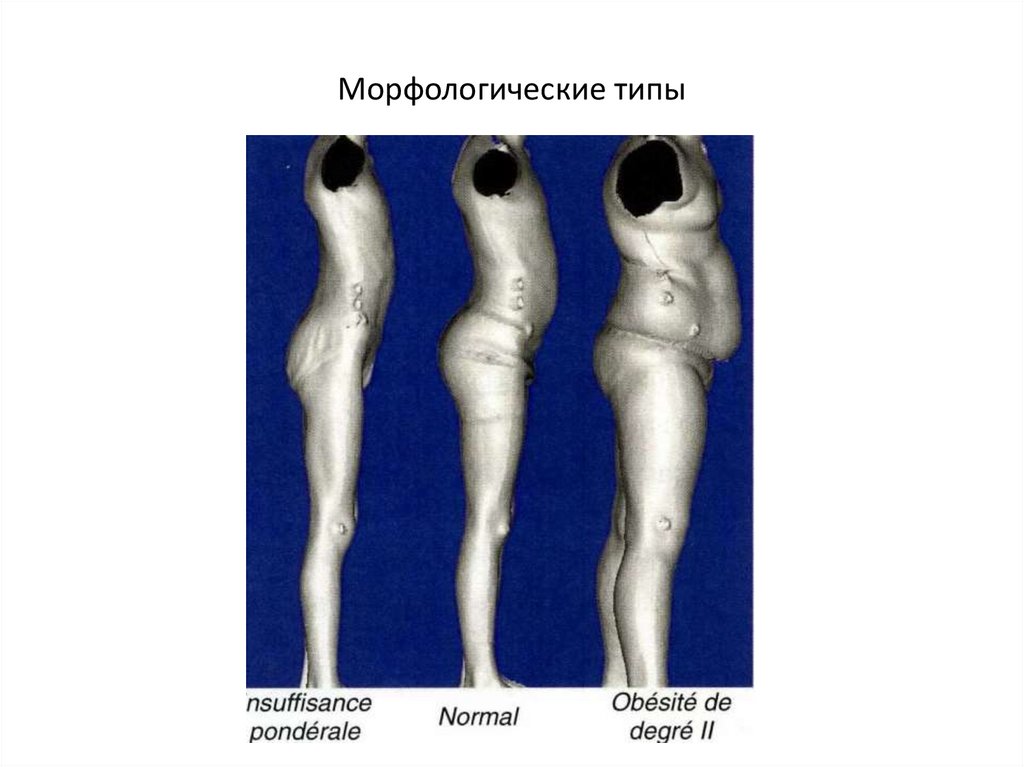 Морфологические типы