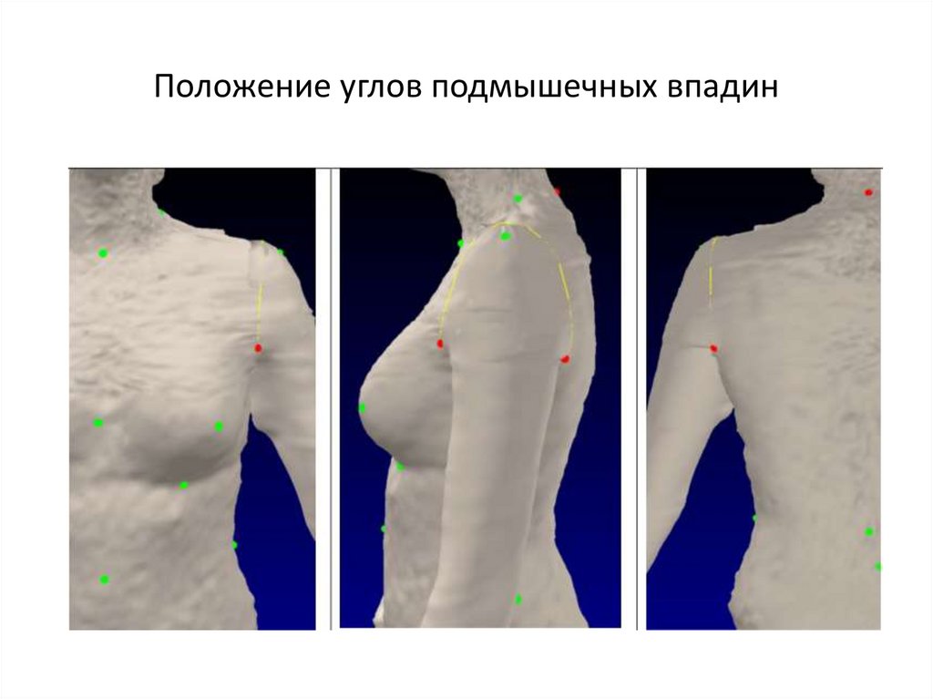 Положение углов подмышечных впадин