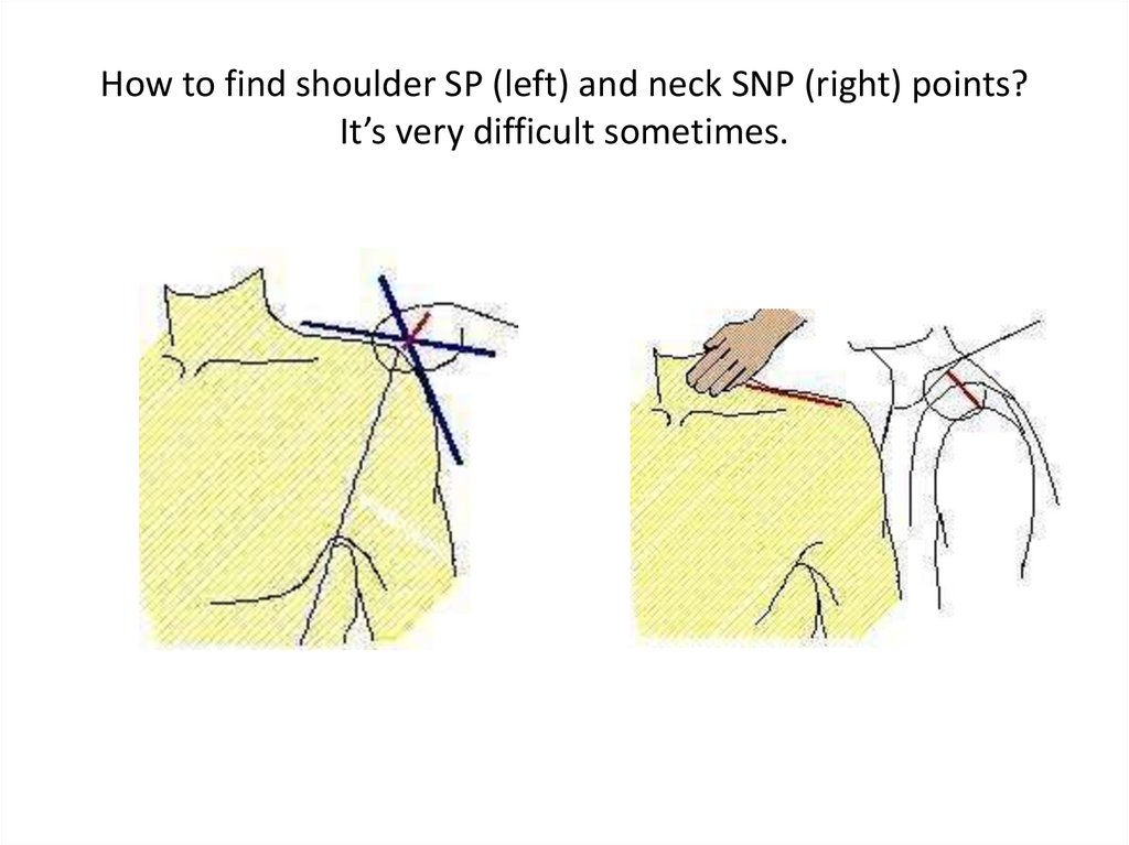 How to find shoulder SP (left) and neck SNP (right) points? It’s very difficult sometimes.