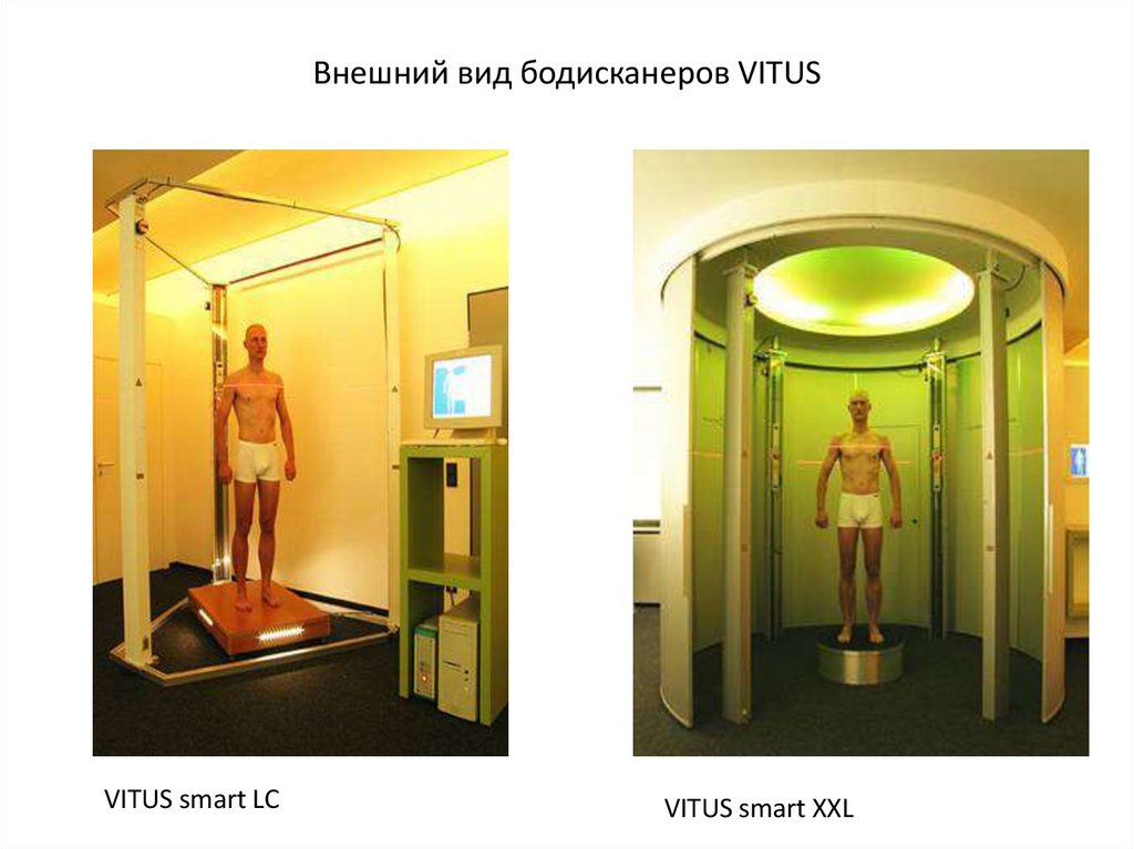 Внешний вид бодисканеров VITUS