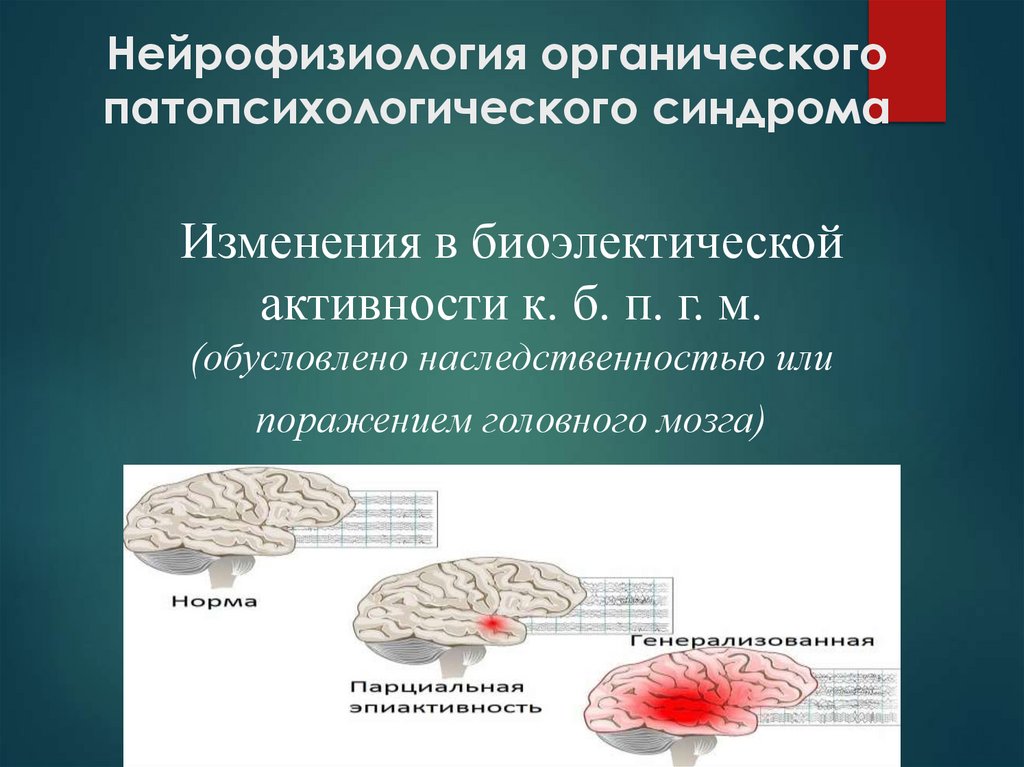 Нейрофизиология органического патопсихологического синдрома