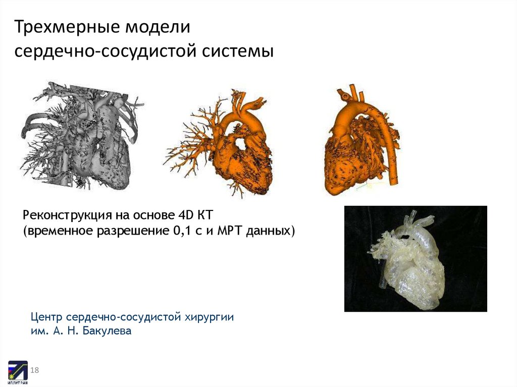 Трехмерные модели сердечно-сосудистой системы