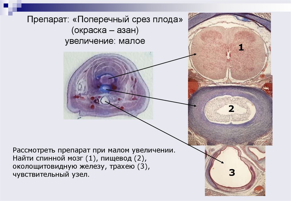Препарат: «Поперечный срез плода» (окраска – азан) увеличение: малое