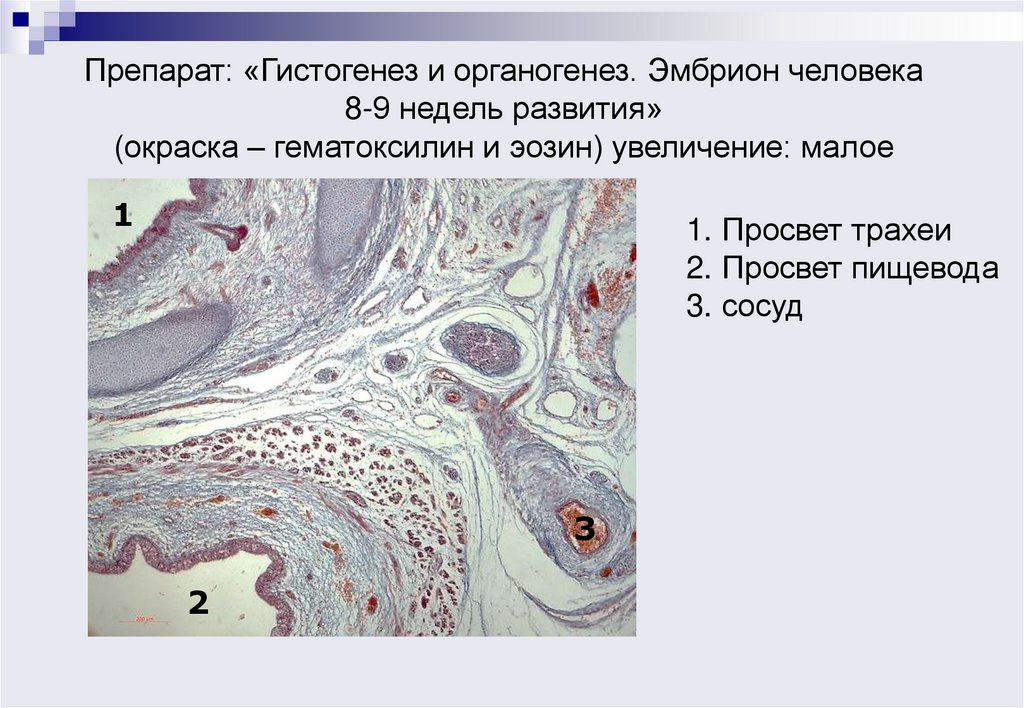 Препарат: «Гистогенез и органогенез. Эмбрион человека 8-9 недель развития» (окраска – гематоксилин и эозин) увеличение: малое