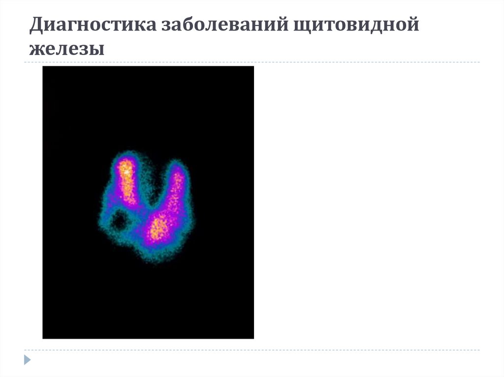Диагностика заболеваний щитовидной железы
