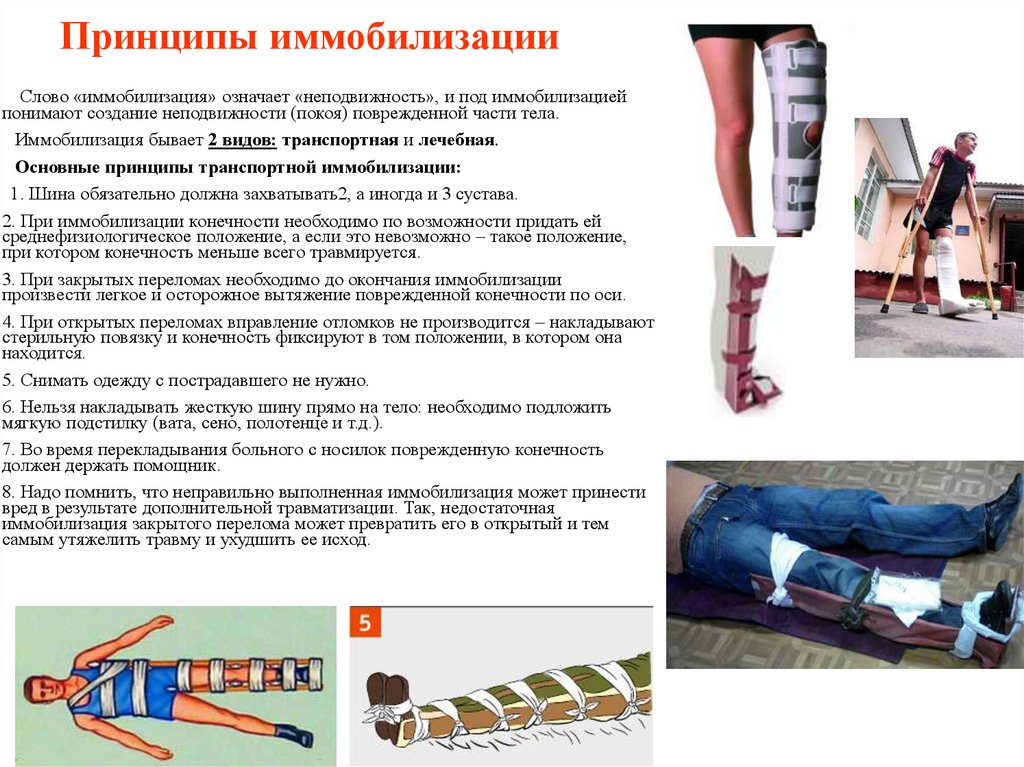 Принципы иммобилизации