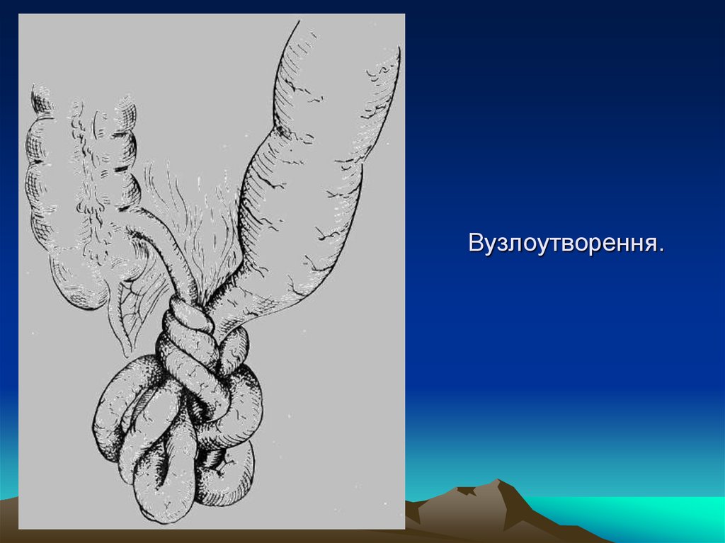 Вузлоутворення.