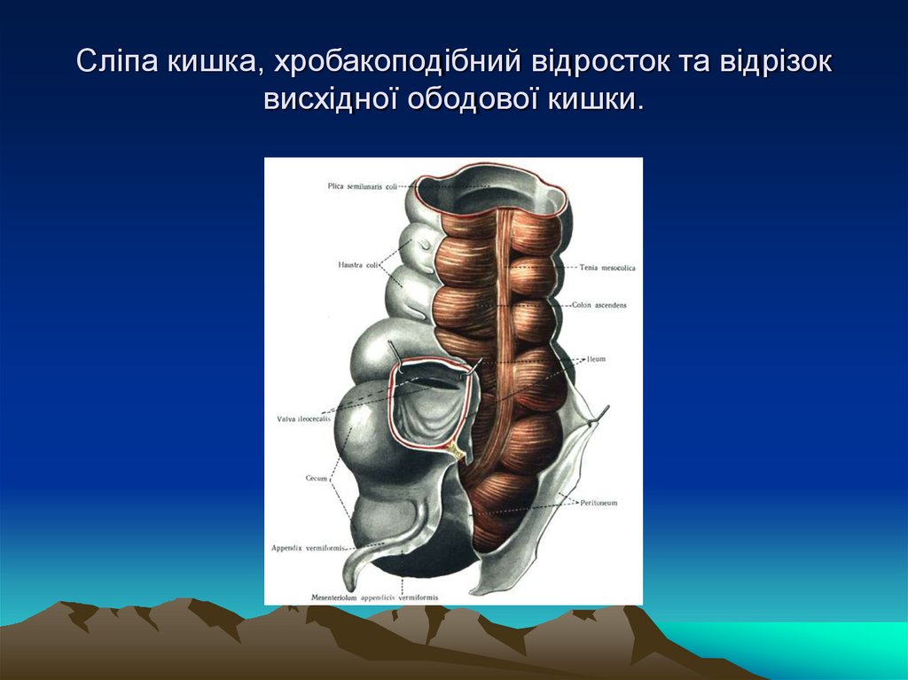 Сліпа кишка, хробакоподібний відросток та відрізок висхідної ободової кишки.
