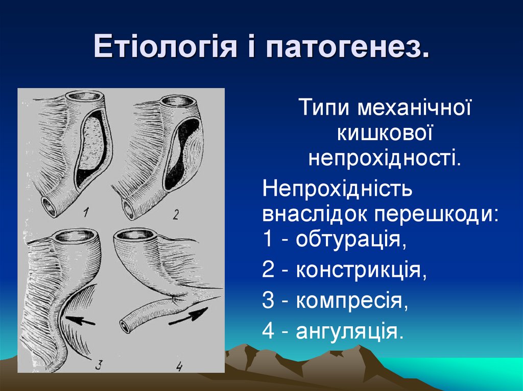 Етіологія і патогенез.