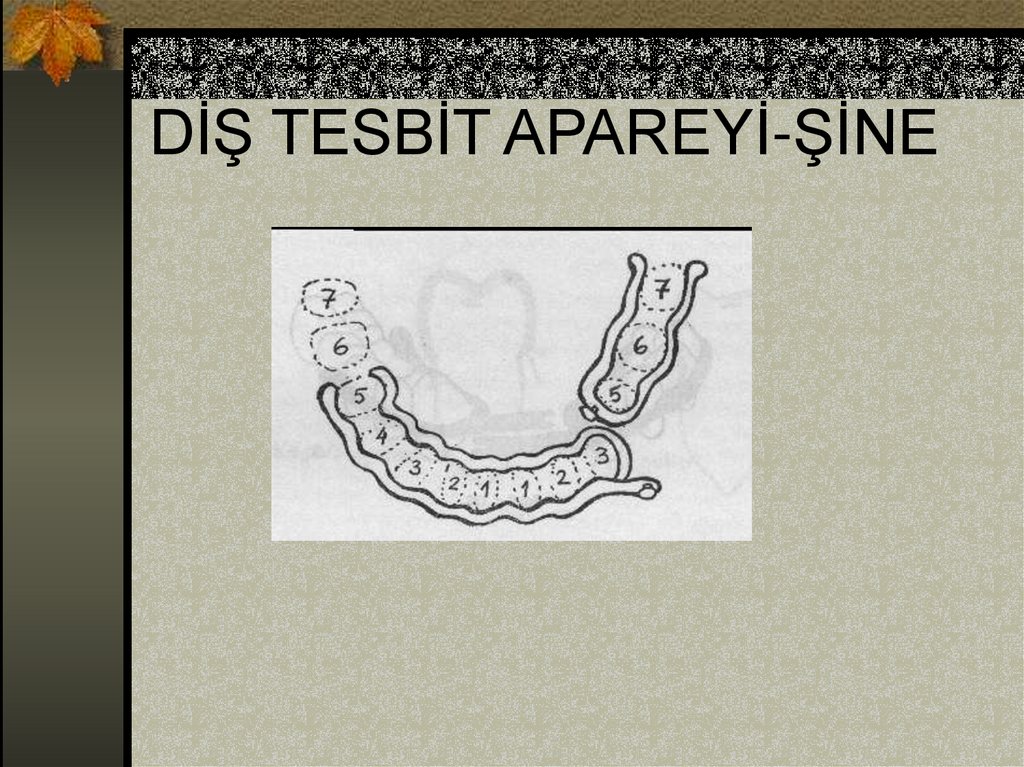 DİŞ TESBİT APAREYİ-ŞİNE