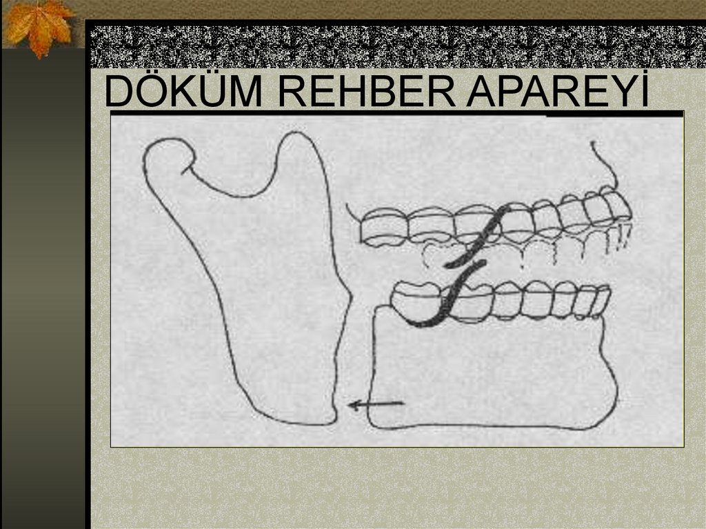 DÖKÜM REHBER APAREYİ