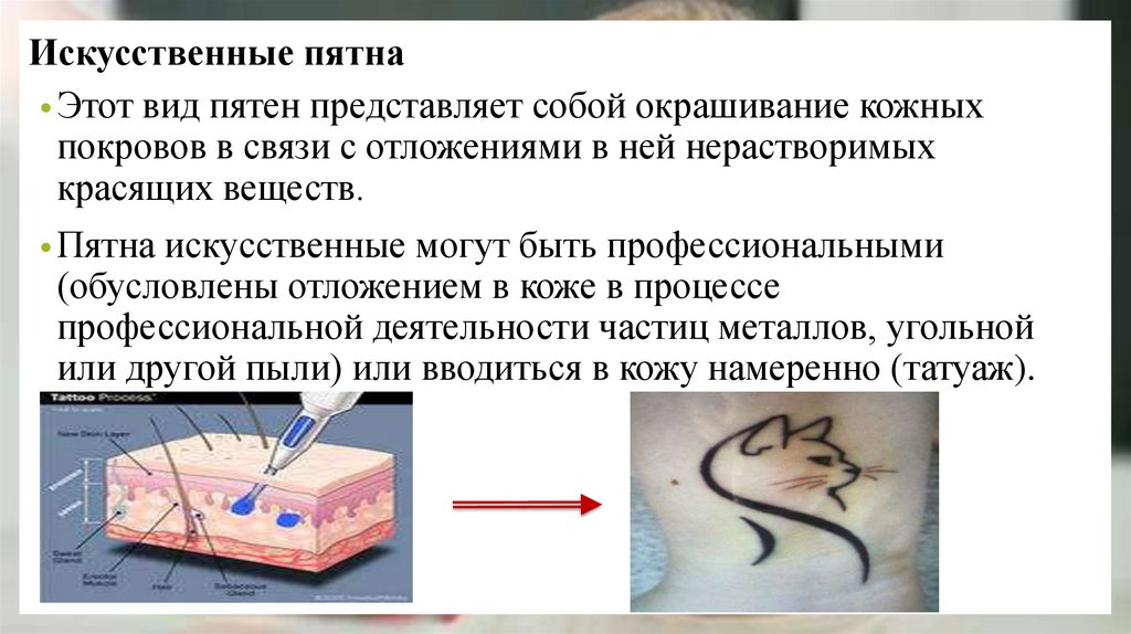 Искусственные пятна