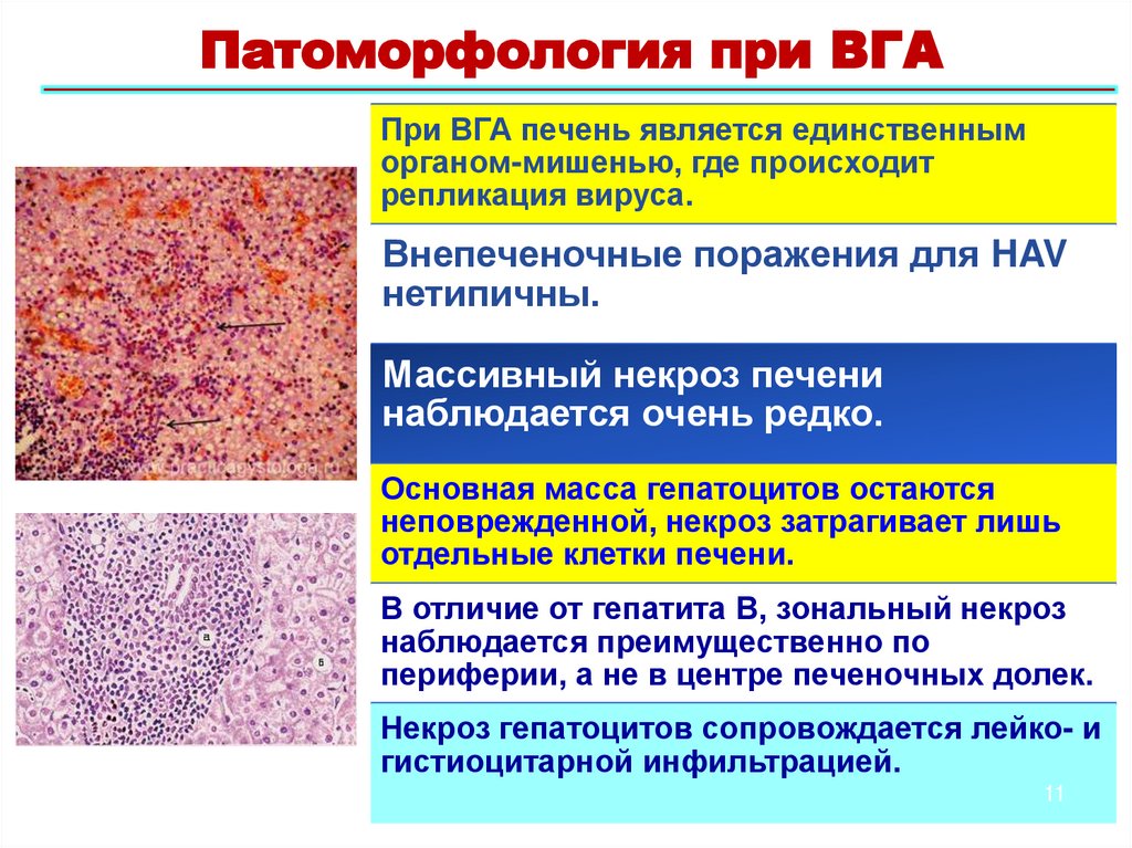 Патоморфология при ВГА