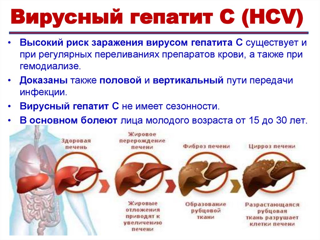 Вирусный гепатит D