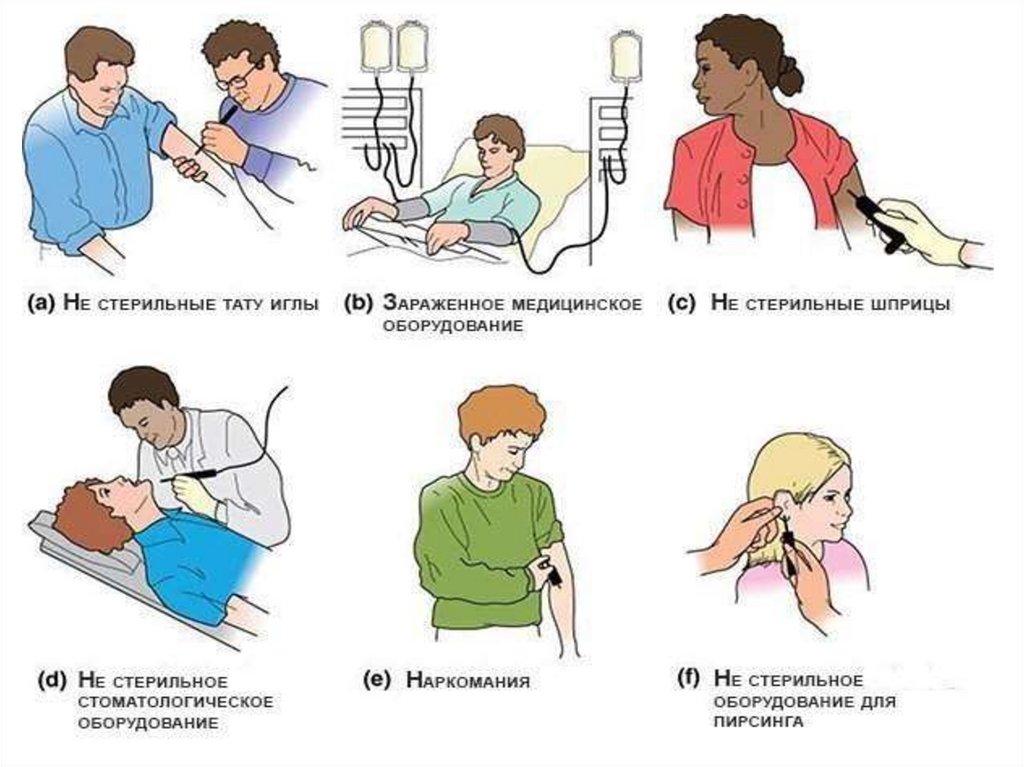 Вирусный гепатит С (HCV)