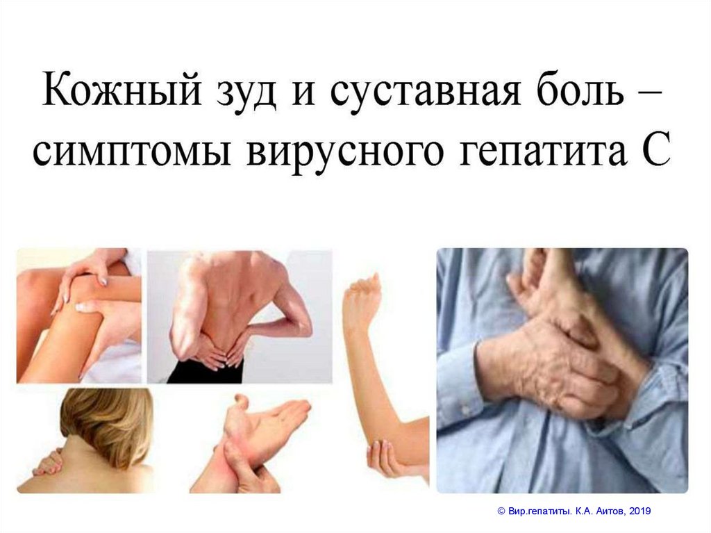 Особенности ВГС