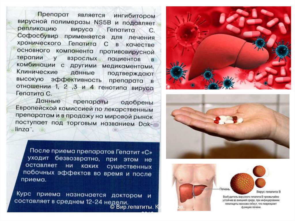 Безинтерфероновое лечение