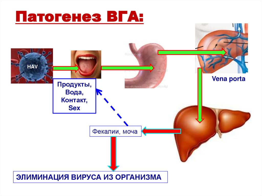 Патогенез ВГА: